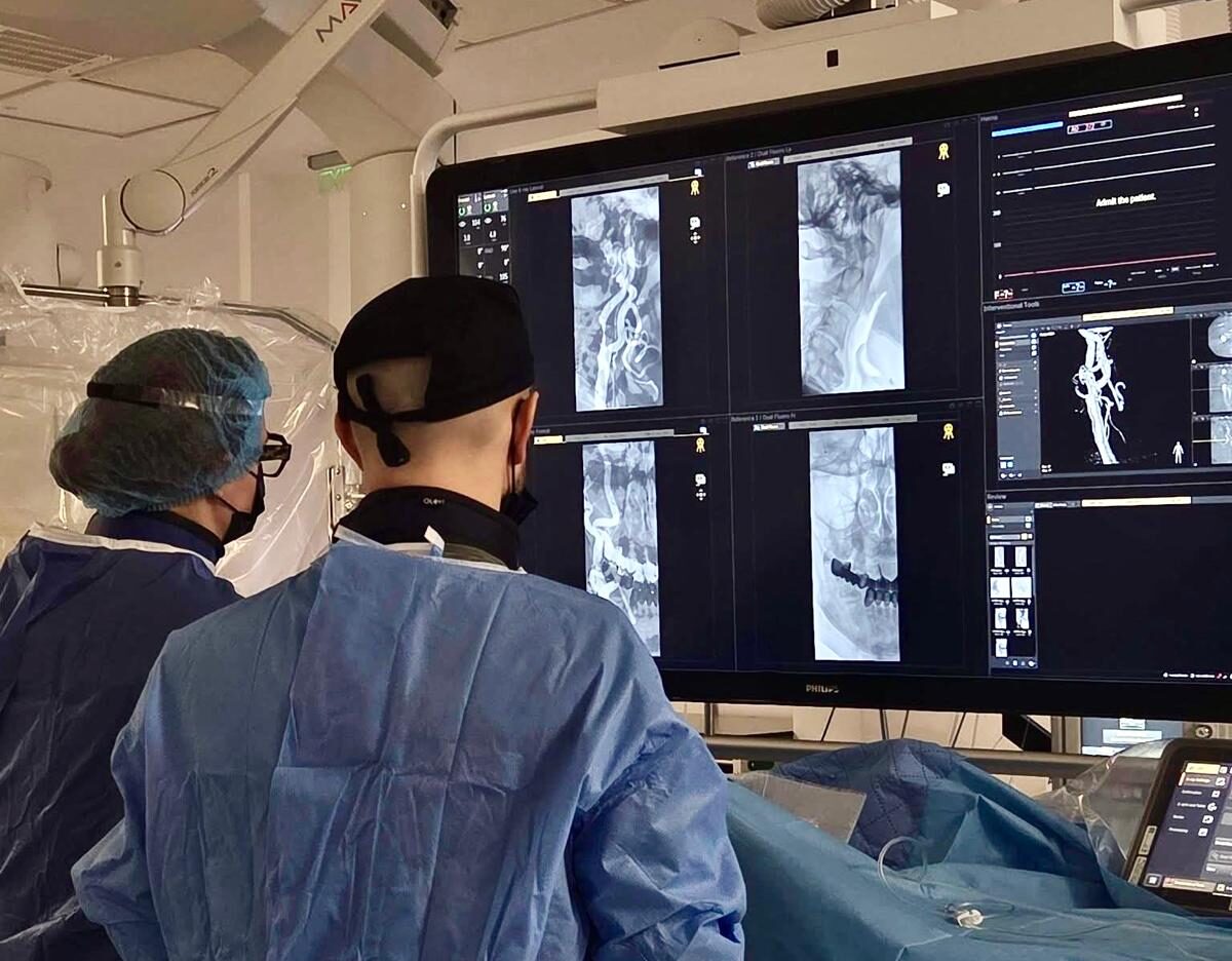 Intervenție care poate preveni AVC-ul, realizată gratuit la Sibiu: pacient de 70 de ani tratat prin stenting carotidian